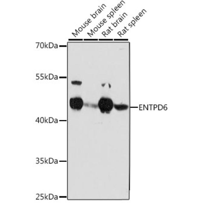 ENTPD6 Rabbit Polyclonal Antibody