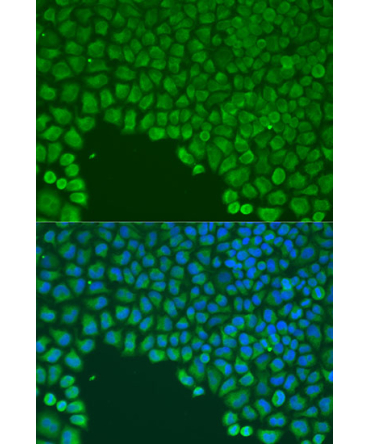 CDC42 Rabbit Polyclonal Antibody