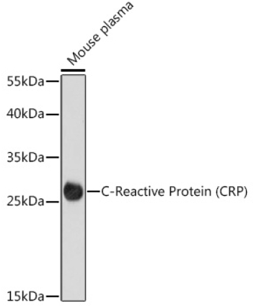C-Reactive Protein (CRP) Rabbit Polyclonal Antibody