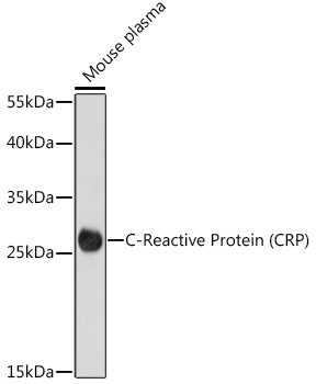C-Reactive Protein (CRP) Rabbit Polyclonal Antibody