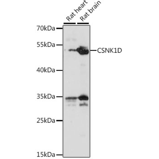 CSNK1D Rabbit Polyclonal Antibody