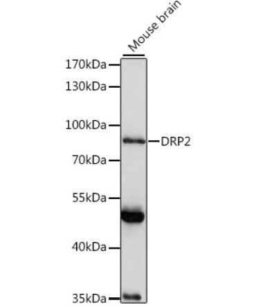 DRP2 Rabbit Polyclonal Antibody