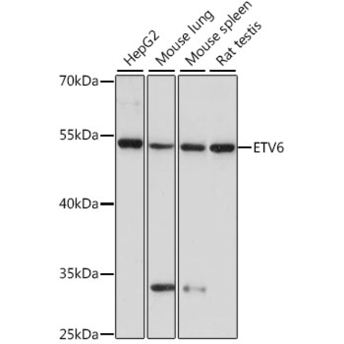 ETV6 Rabbit Polyclonal Antibody