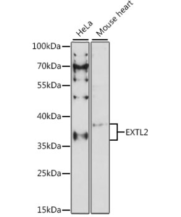 EXTL2 Rabbit Polyclonal Antibody