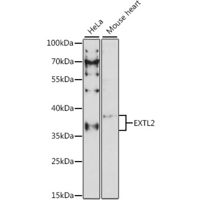 EXTL2 Rabbit Polyclonal Antibody