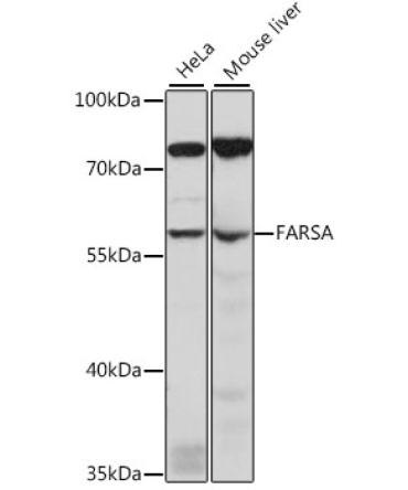 FARSA Rabbit Polyclonal Antibody