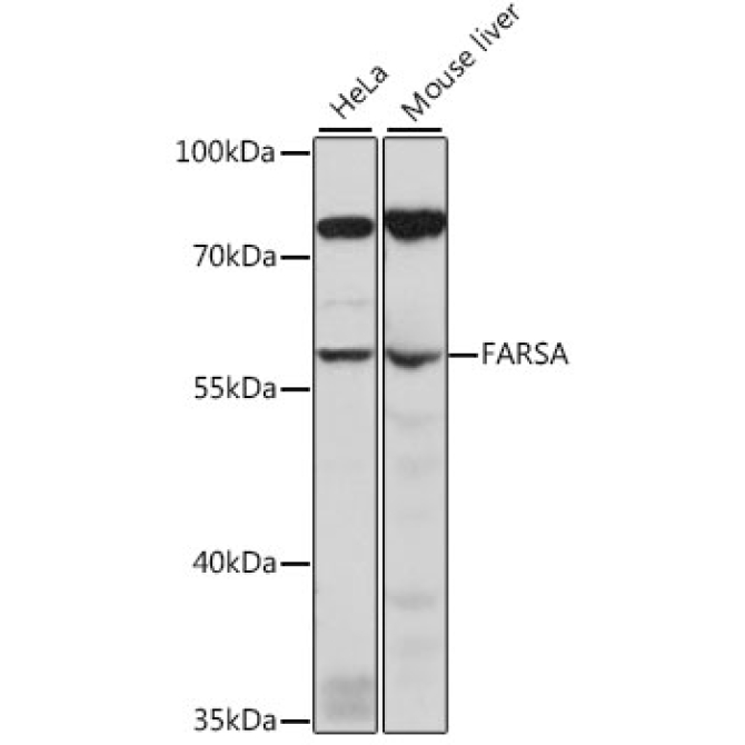 FARSA Rabbit Polyclonal Antibody