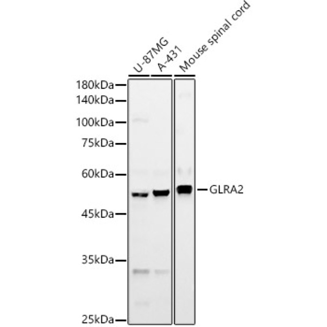 GLRA2 Rabbit Polyclonal Antibody