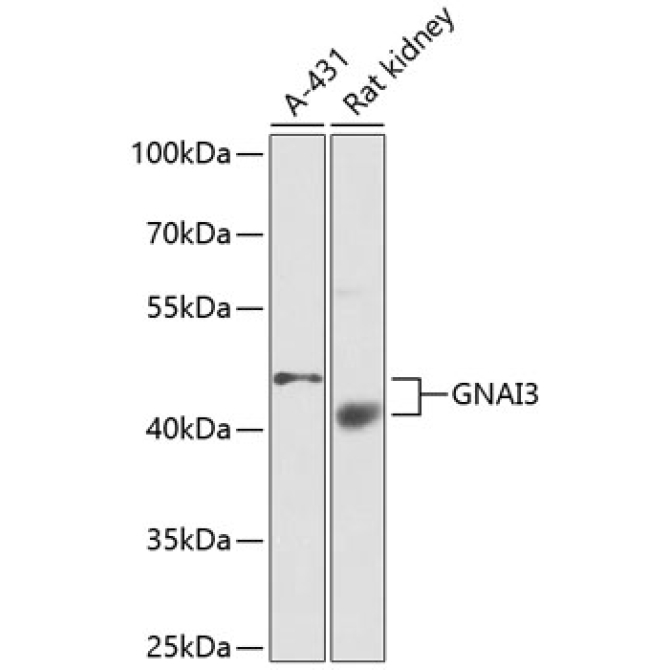 GNAI3 Rabbit Polyclonal Antibody