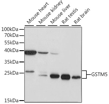 GSTM5 Rabbit Polyclonal Antibody