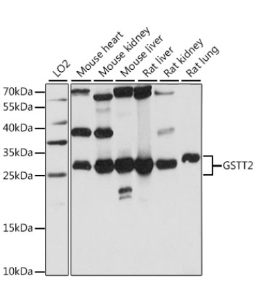 GSTT2 Rabbit Polyclonal Antibody