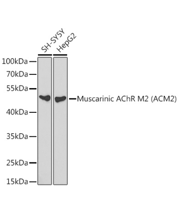 Muscarinic AChR M2 (ACM2) Rabbit Polyclonal Antibody