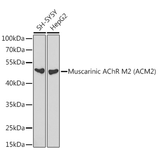 Muscarinic AChR M2 (ACM2) Rabbit Polyclonal Antibody