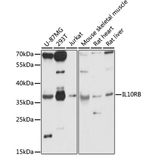 IL10RB Rabbit Polyclonal Antibody