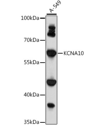 KCNA10 Rabbit Polyclonal Antibody