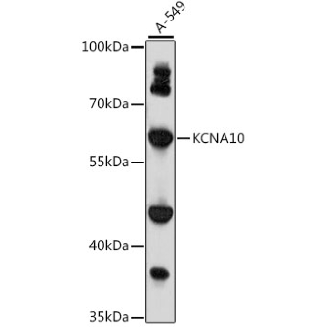 KCNA10 Rabbit Polyclonal Antibody