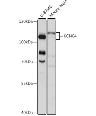 KCNC4 Rabbit Polyclonal Antibody