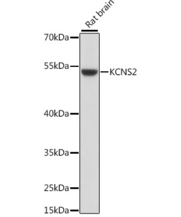 KCNS2 Rabbit Polyclonal Antibody