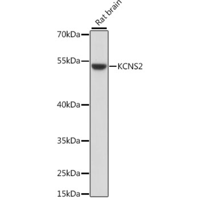 KCNS2 Rabbit Polyclonal Antibody