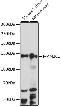 MAN2C1 Rabbit Polyclonal Antibody