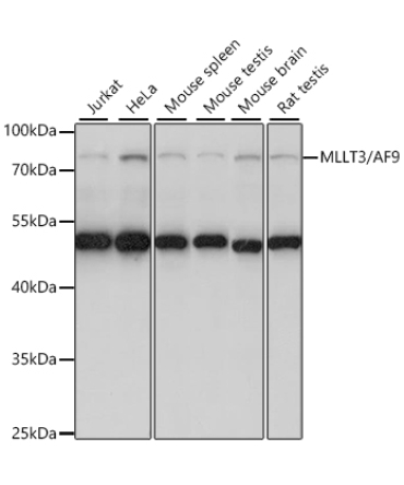 MLLT3/AF9 Rabbit Polyclonal Antibody