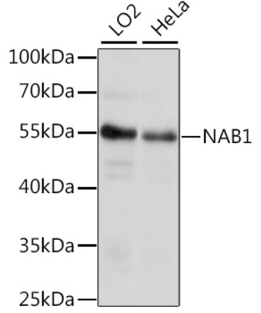 NAB1 Rabbit Polyclonal Antibody