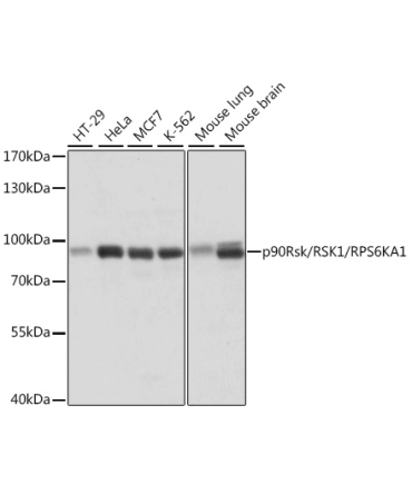 p90Rsk/RSK1/RPS6KA1 Rabbit Polyclonal Antibody