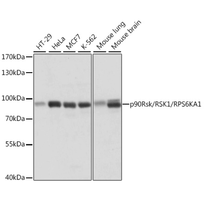 p90Rsk/RSK1/RPS6KA1 Rabbit Polyclonal Antibody