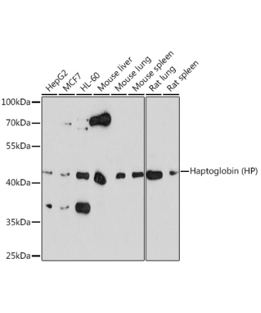Haptoglobin (HP) Rabbit Polyclonal Antibody