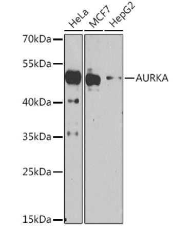 AURKA Rabbit Polyclonal Antibody