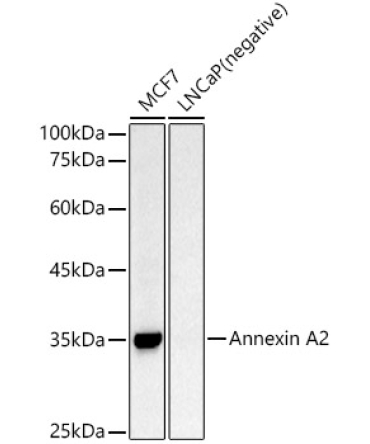 Annexin A2 Rabbit Polyclonal Antibody