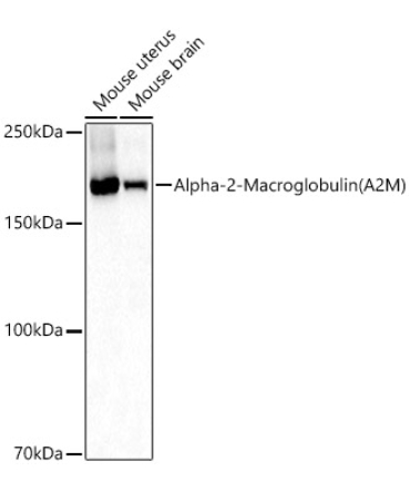 Alpha-2-Macroglobulin (A2M) Rabbit Polyclonal Antibody