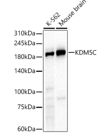 KDM5C Rabbit Polyclonal Antibody