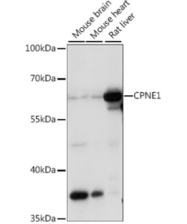 CPNE1 Rabbit Polyclonal Antibody