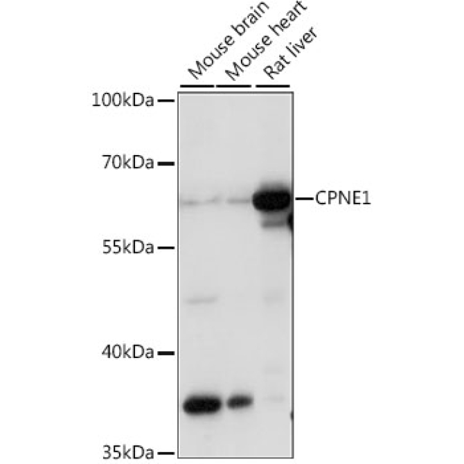 CPNE1 Rabbit Polyclonal Antibody