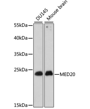 MED20 Rabbit Polyclonal Antibody