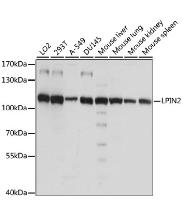LPIN2 Rabbit Polyclonal Antibody