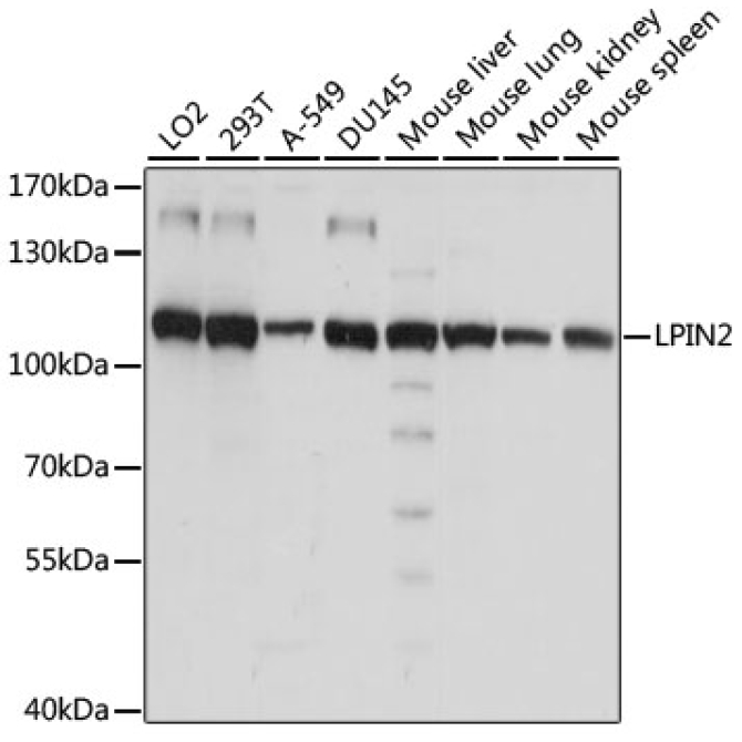 LPIN2 Rabbit Polyclonal Antibody