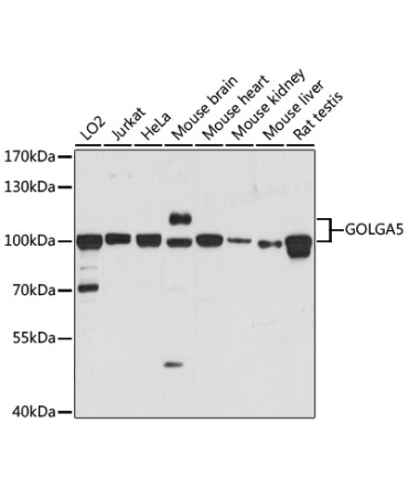 GOLGA5 Rabbit Polyclonal Antibody