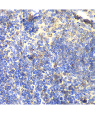 BTK Rabbit Polyclonal Antibody