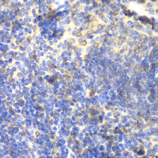 BTK Rabbit Polyclonal Antibody