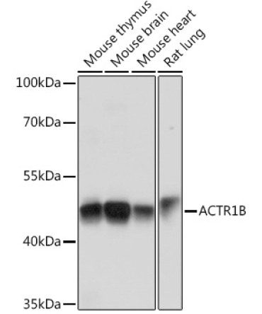 ACTR1B Rabbit Polyclonal Antibody