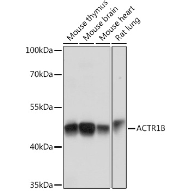 ACTR1B Rabbit Polyclonal Antibody