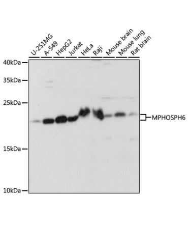 MPHOSPH6 Rabbit Polyclonal Antibody