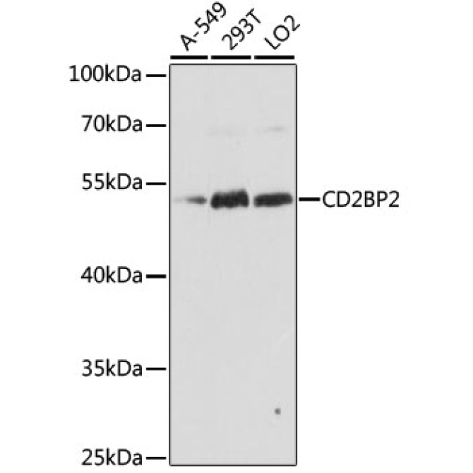 CD2BP2 Rabbit Polyclonal Antibody
