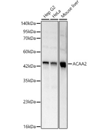 ACAA2 Rabbit Polyclonal Antibody
