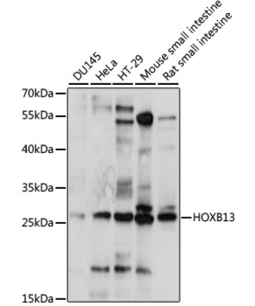HOXB13 Rabbit Polyclonal Antibody