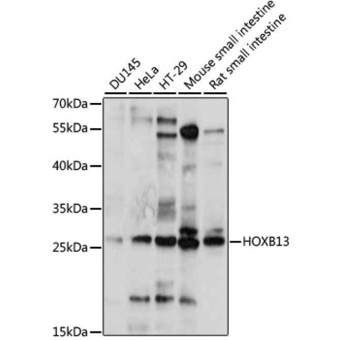 HOXB13 Rabbit Polyclonal Antibody