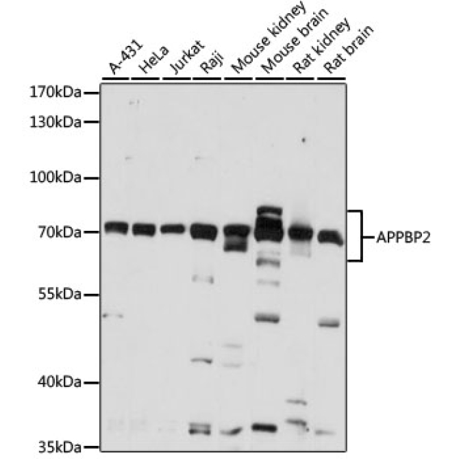 APPBP2 Rabbit Polyclonal Antibody