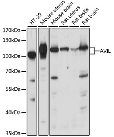 AVIL Rabbit Polyclonal Antibody